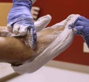 Foot and Ankle Surgical Associates