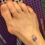 Foot Image